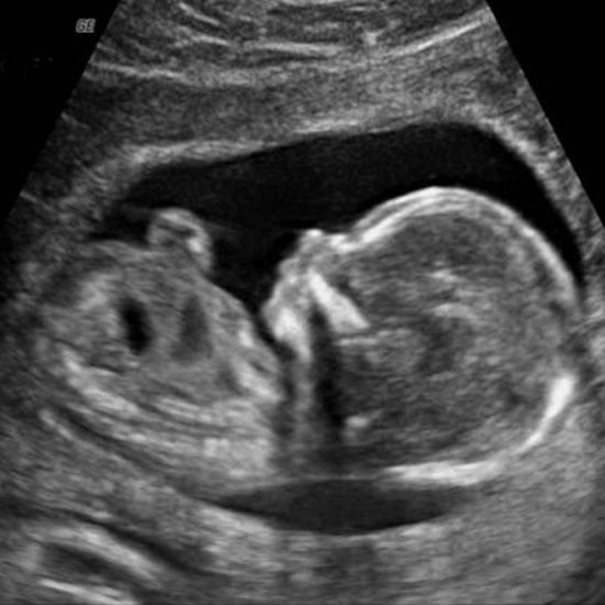 Private Ultrasound: A Closer Look at this Growing Trend